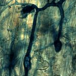 La vie des mycorhizes au fil des saisons